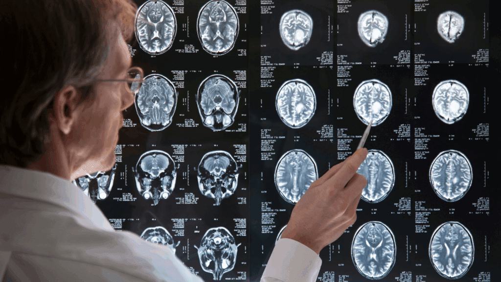 A doctor reviews detailed brain scans, focusing on neural pathways involved in the neuroscience of anxiety.